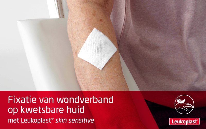 Hier zien we hoe een wondverband op een zeer gevoelige huid kan worden aangebracht en geherpositioneerd  met een fixatiepleister: een zorgprofessional bevestigt een kompres op de onderarm van een oudere vrouw met een kwetsbare huid, met behulp van Leukoplast skin sensitive. Hier zien we hoe een wondverband op een zeer gevoelige huid kan worden aangebracht en geherpositioneerd  met een fixatiepleister: een zorgprofessional bevestigt een kompres op de onderarm van een oudere vrouw met een kwetsbare huid, met behulp van Leukoplast skin sensitive.